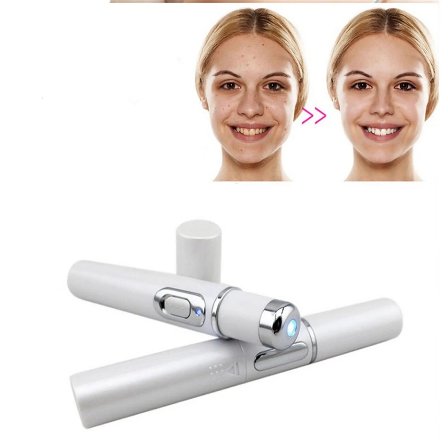 Wrinkle Blemish Pore Acne Scar Remover Pen - Quality & Innovation - Getixt